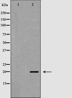 Invitrogen TAF9 Polyclonal Antibody 100 &mu;L | Buy Online | Invitrogen&trade; | Fisher Scientific