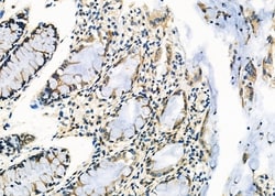 Invitrogen Ubiquitin Polyclonal Antibody 100 &mu;L; Unconjugated:Antibodies,