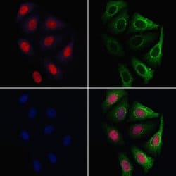 Invitrogen Ubiquitin Polyclonal Antibody 100 &mu;L; Unconjugated:Antibodies,