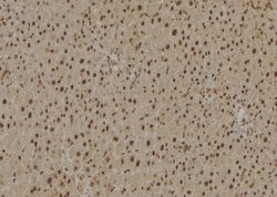 Invitrogen Ubiquitin Polyclonal Antibody 100 &mu;L; Unconjugated:Antibodies,