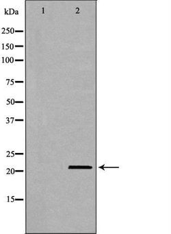Invitrogen CD70 Polyclonal Antibody 100 &mu;L; Unconjugated:Antibodies,