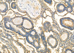 Invitrogen ADH5 Polyclonal Antibody 100 &mu;L; Unconjugated:Antibodies,