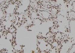 Invitrogen LHX8 Polyclonal Antibody 100 &mu;L | Buy Online | Invitrogen&trade; | Fisher Scientific