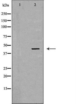 Invitrogen LHX8 Polyclonal Antibody 100 &mu;L | Buy Online | Invitrogen&trade; | Fisher Scientific