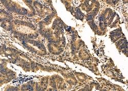 Invitrogen CAPZA2 Polyclonal Antibody 100 &mu;L; Unconjugated:Antibodies,