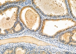 Invitrogen CAPZA2 Polyclonal Antibody 100 &mu;L; Unconjugated:Antibodies,