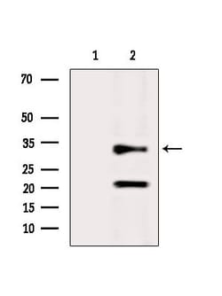 Invitrogen CAPZA2 Polyclonal Antibody 100 &mu;L; Unconjugated:Antibodies,