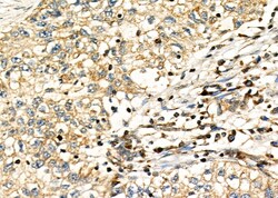 Invitrogen CD33 Polyclonal Antibody 100 &mu;L | Buy Online | Invitrogen&trade; | Fisher Scientific