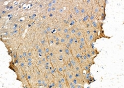 Invitrogen EPHX1 Polyclonal Antibody 100 &mu;L | Buy Online | Invitrogen&trade; | Fisher Scientific