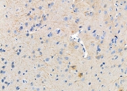 Invitrogen EPHX1 Polyclonal Antibody 100 &mu;L | Buy Online | Invitrogen&trade; | Fisher Scientific