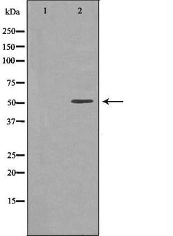 Invitrogen EPHX1 Polyclonal Antibody 100 &mu;L | Buy Online | Invitrogen&trade; | Fisher Scientific
