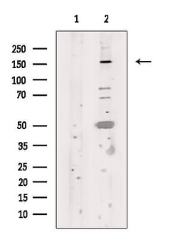 FANCD2 Polyclonal Antibody:Antibodies, Polyclonal