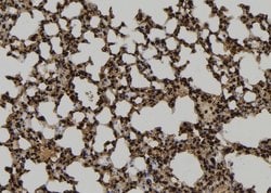 HCK Polyclonal Antibody 100 &mu;L | Buy Online | Thermo Scientific | Fisher Scientific