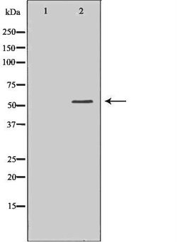 HCK Polyclonal Antibody 100 &mu;L | Buy Online | Thermo Scientific | Fisher Scientific