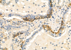 Invitrogen IL-13 Polyclonal Antibody 100 &mu;L; Unconjugated:Antibodies,