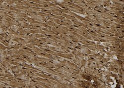 Invitrogen PKC epsilon Polyclonal Antibody 100 &mu;L; Unconjugated:Antibodies,