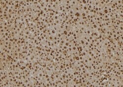 Invitrogen SCCPDH Polyclonal Antibody 100 &mu;L; Unconjugated:Antibodies,