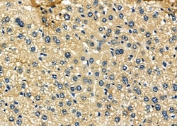Invitrogen SCCPDH Polyclonal Antibody 100 &mu;L; Unconjugated:Antibodies,