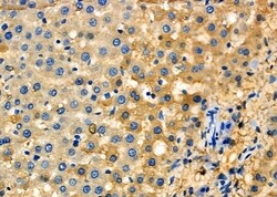 Invitrogen SCCPDH Polyclonal Antibody 100 &mu;L; Unconjugated:Antibodies,
