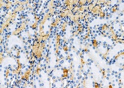 Invitrogen SCCPDH Polyclonal Antibody 100 &mu;L; Unconjugated:Antibodies,