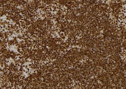 Invitrogen KBTBD3 Polyclonal Antibody 100 &mu;L; Unconjugated:Antibodies,