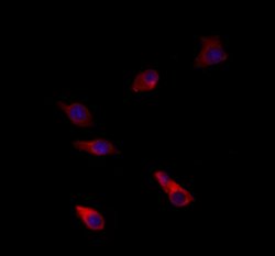 Invitrogen BNP Polyclonal Antibody 100 &mu;L; Unconjugated:Antibodies,