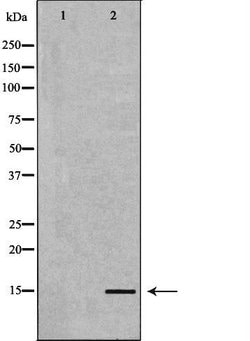 Invitrogen BNP Polyclonal Antibody 100 &mu;L; Unconjugated:Antibodies,