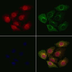Invitrogen PP1 alpha Polyclonal Antibody 100 &mu;L | Buy Online | Invitrogen&trade; | Fisher Scientific
