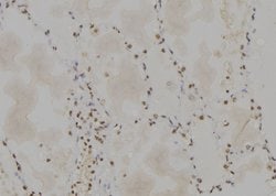 Invitrogen PP1 alpha Polyclonal Antibody 100 &mu;L | Buy Online | Invitrogen&trade; | Fisher Scientific