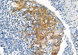 Invitrogen PP1 alpha Polyclonal Antibody 100 &mu;L | Buy Online | Invitrogen&trade; | Fisher Scientific