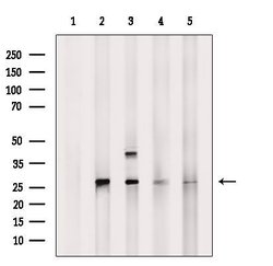 Invitrogen PSMA6 Polyclonal Antibody 100 &mu;L; Unconjugated:Antibodies,