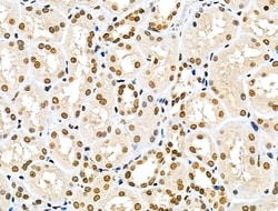 Invitrogen MDA5 Polyclonal Antibody 100 &mu;L; Unconjugated:Antibodies,