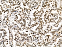 Invitrogen MDA5 Polyclonal Antibody 100 &mu;L; Unconjugated:Antibodies,