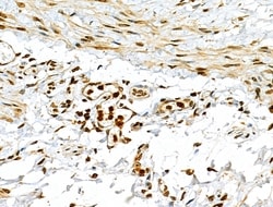 Invitrogen MDA5 Polyclonal Antibody 100 &mu;L; Unconjugated:Antibodies,