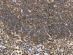 Invitrogen MDA5 Polyclonal Antibody 100 &mu;L; Unconjugated:Antibodies,