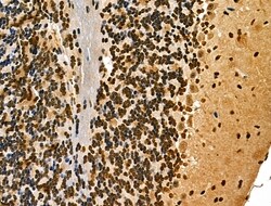 Invitrogen MDA5 Polyclonal Antibody 100 &mu;L; Unconjugated:Antibodies,