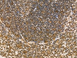 Invitrogen MDA5 Polyclonal Antibody 100 &mu;L; Unconjugated:Antibodies,