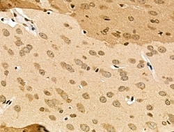 Invitrogen MDA5 Polyclonal Antibody 100 &mu;L; Unconjugated:Antibodies,