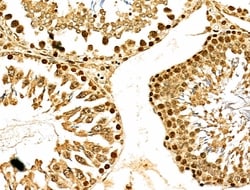 Invitrogen MDA5 Polyclonal Antibody 100 &mu;L; Unconjugated:Antibodies,