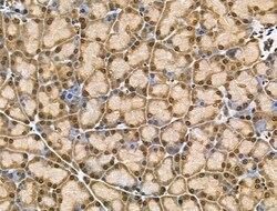 Invitrogen MDA5 Polyclonal Antibody 100 &mu;L; Unconjugated:Antibodies,