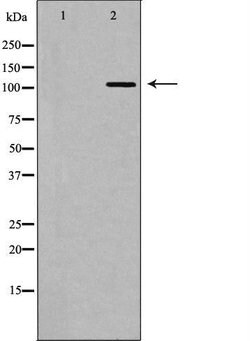 Invitrogen MDA5 Polyclonal Antibody 100 &mu;L; Unconjugated:Antibodies,