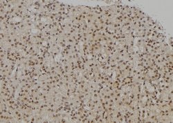 Invitrogen UHRF2 Polyclonal Antibody 100 &mu;L; Unconjugated:Antibodies,