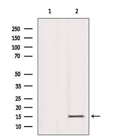 Invitrogen H3K79me3 Polyclonal Antibody 100 &mu;L | Buy Online | Invitrogen&trade; | Fisher Scientific