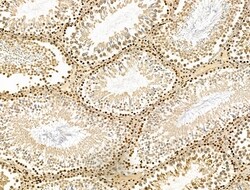 Invitrogen H4K20me1 Polyclonal Antibody 100 &mu;L; Unconjugated:Antibodies,