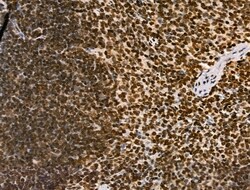 Invitrogen H4K20me1 Polyclonal Antibody 100 &mu;L; Unconjugated:Antibodies,
