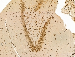 Invitrogen H4K20me1 Polyclonal Antibody 100 &mu;L; Unconjugated:Antibodies,