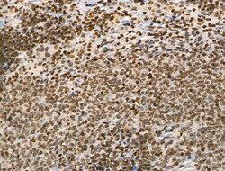 Invitrogen H4K20me1 Polyclonal Antibody 100 &mu;L; Unconjugated:Antibodies,