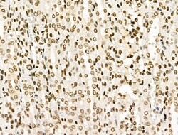 Invitrogen H4K20me1 Polyclonal Antibody 100 &mu;L; Unconjugated:Antibodies,