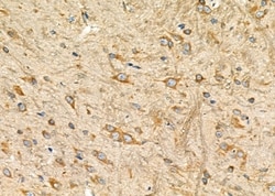 Invitrogen SIAH1 Polyclonal Antibody 100 &mu;L; Unconjugated:Antibodies,