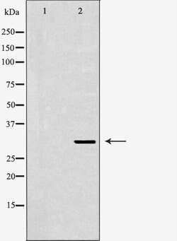 Invitrogen SIAH1 Polyclonal Antibody 100 &mu;L; Unconjugated:Antibodies,